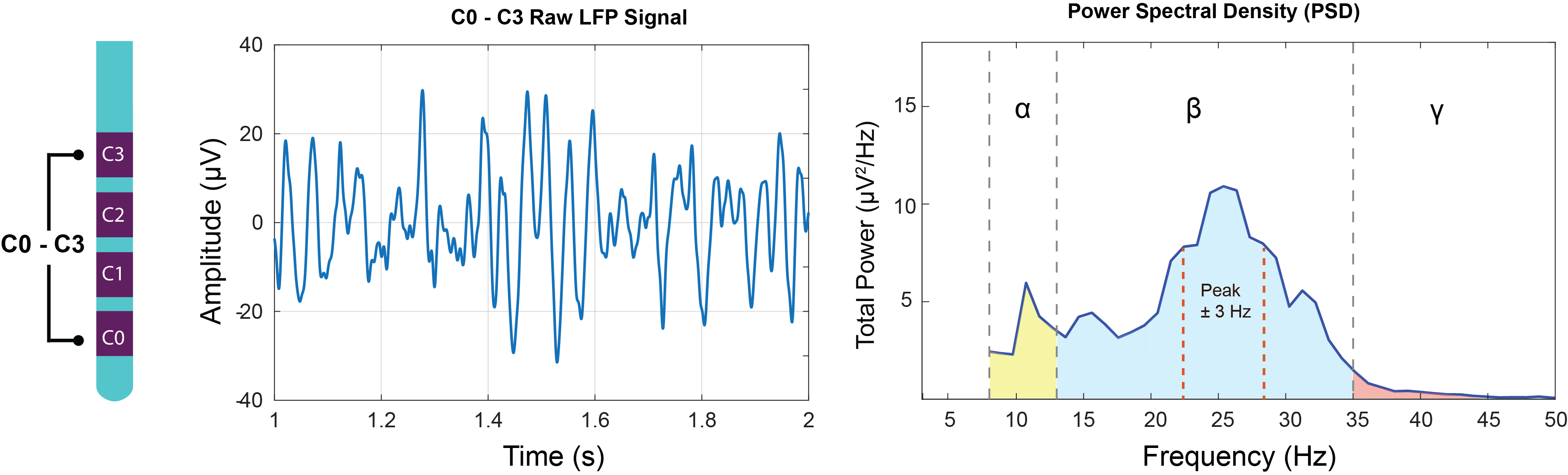 DBS lead with labeled ring electrodes C0 through C3; bipolar LFP time series between contacts 0 and 3; and the corresponding power spectral density, with color-coded alpha, beta, and gamma frequency bands and the beta peak plus or minus 3 Hz marked